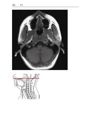 Tài liệu Giải phẫu cắt lớp CT-MRI - Quyển 1: Phần đầu & cổ (Phần 2)