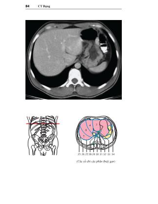 Tài liệu Giải phẫu cắt lớp CT-MRI - Quyển 2: Phần Ngực - Bụng - Chậu (Phần 2)